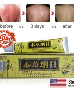 Naravna zeliščna krema za napredovalo psoriazo in ekcem