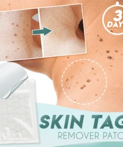 Obliž za odstranjevanje kožnih oznak (36 KOSOV)