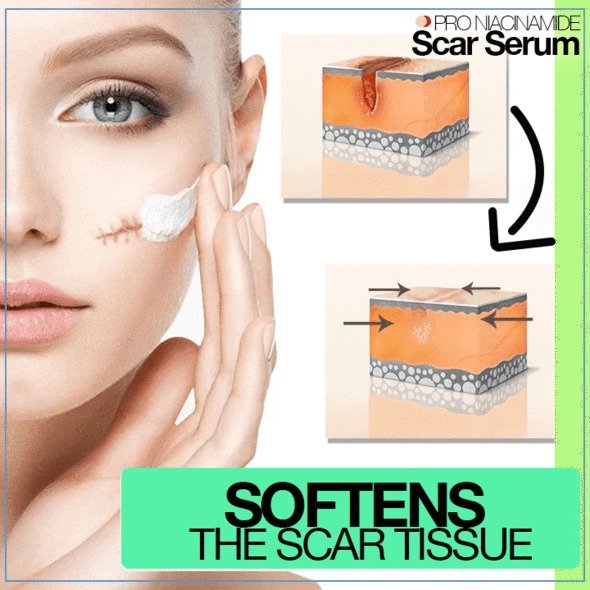 PRO niacinamidni serum za brazgotine - Image 2