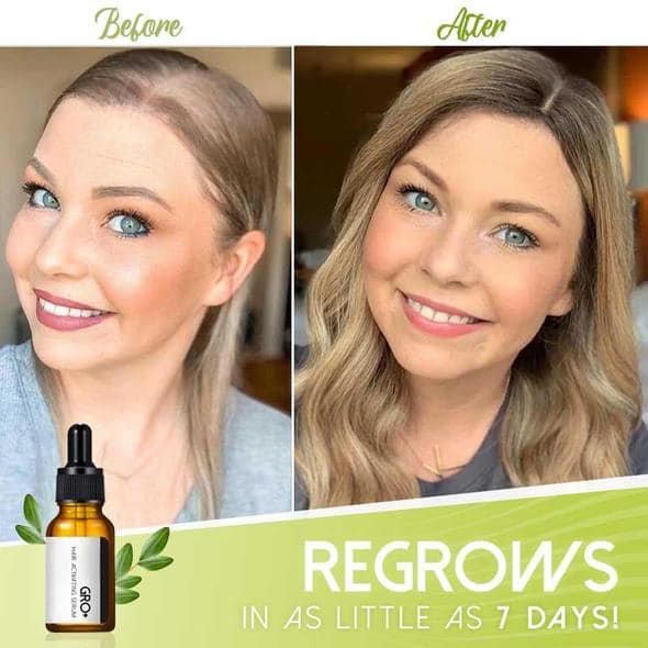 Serum za aktiviranje las Gro+ - Image 3