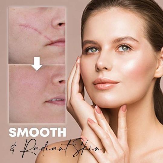 Medease Skin Rebound krema - Image 3