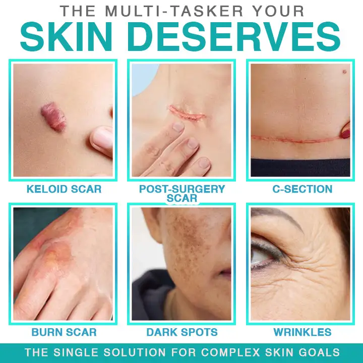 𝗖𝗮𝗿𝗲𝗕𝗿𝗲𝗲𝘇𝗲® obliž za nego z mikroiglami 3 v 1 - Image 2