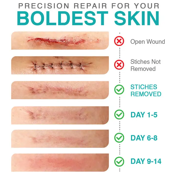 𝗖𝗮𝗿𝗲𝗕𝗿𝗲𝗲𝘇𝗲® obliž za nego z mikroiglami 3 v 1 - Image 4