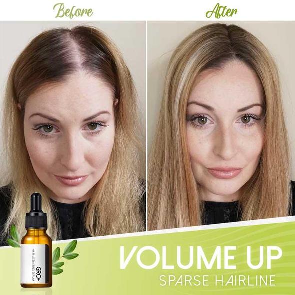 Serum za aktiviranje las Gro+ - Image 4