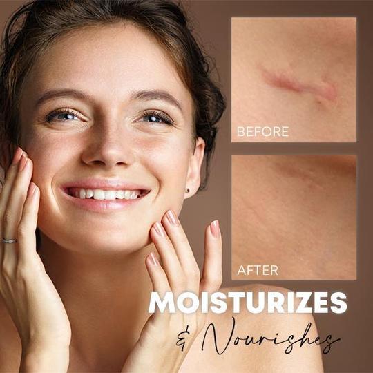 Medease Skin Rebound krema - Image 4