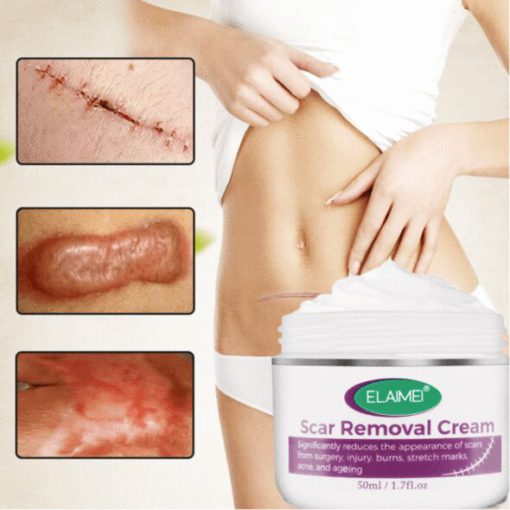 Skin Rebound Scarless krema - Image 4