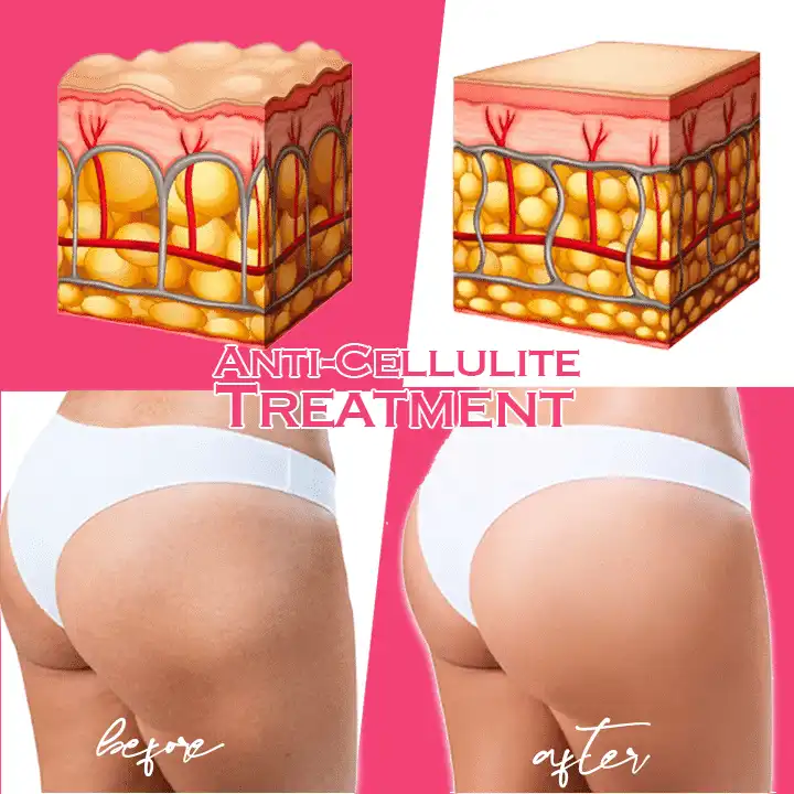 Učvrstitvena in tonična krema s kofeinom - Image 4