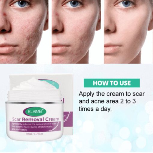 Skin Rebound Scarless krema - Image 5