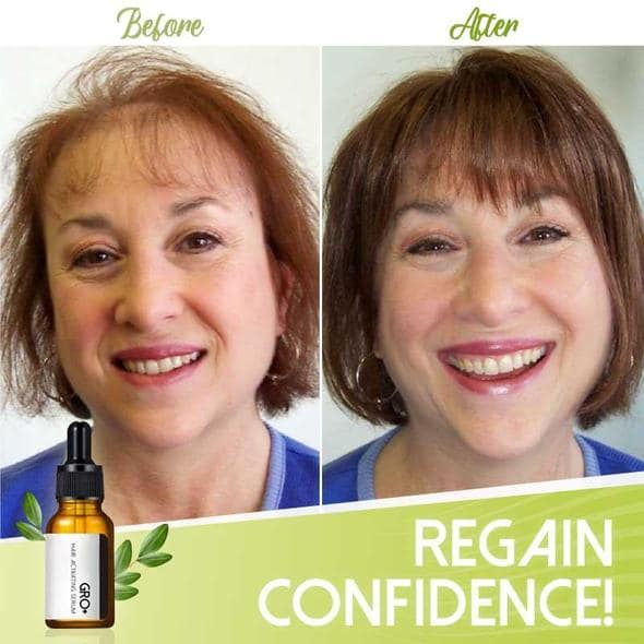 Serum za aktiviranje las Gro+ - Image 6