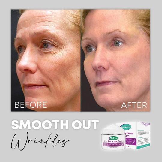 Medease Skin Rebound krema - Image 7