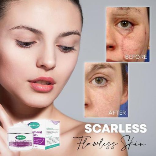 Medease Skin Rebound krema