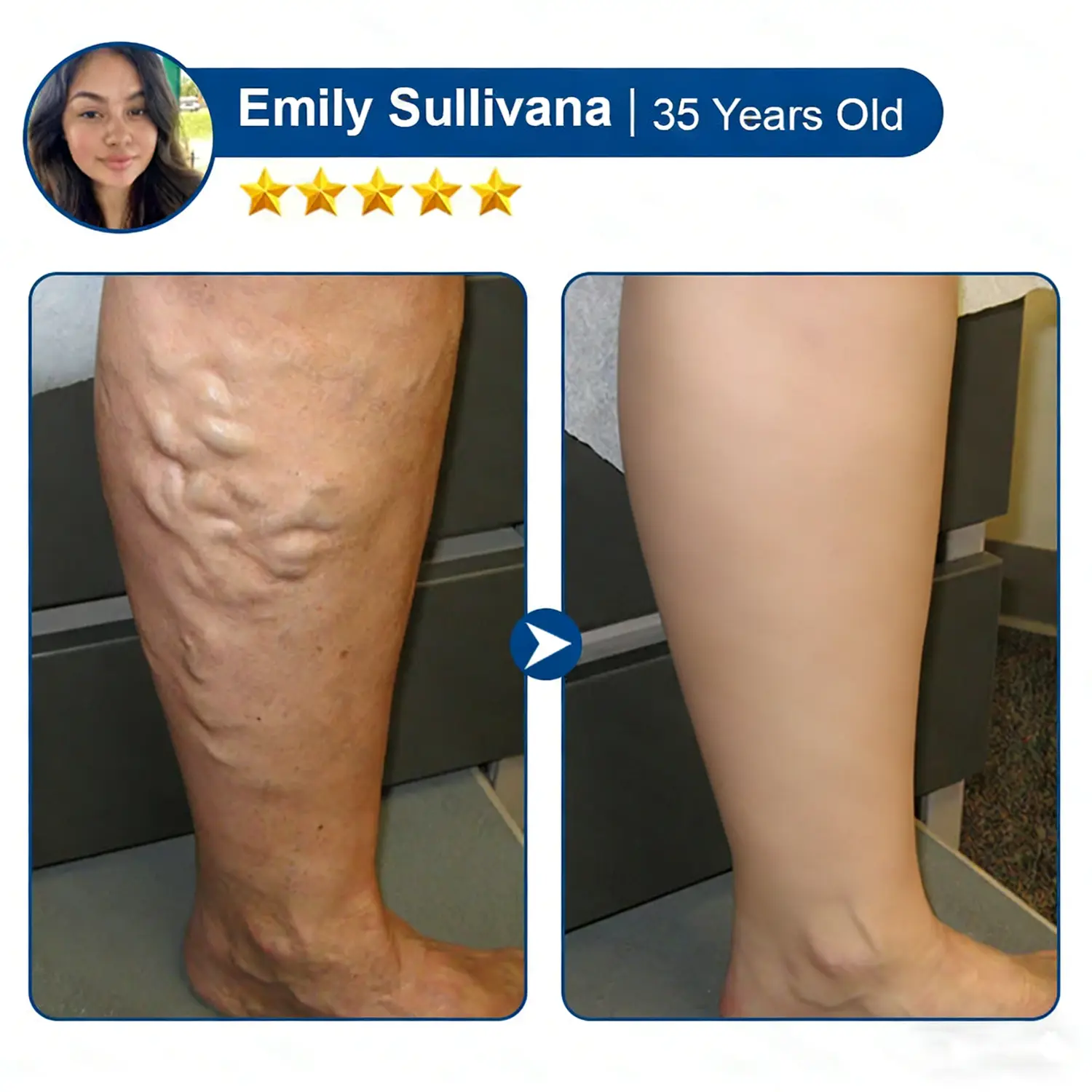 Virexo™ - Image 11